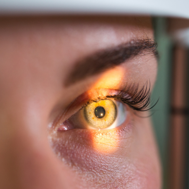 Vision Therapy in West Chester